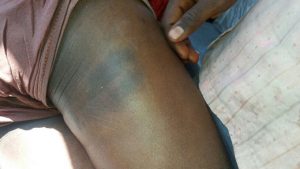 dalit-beaten-to-death-for-sprinking-colour1