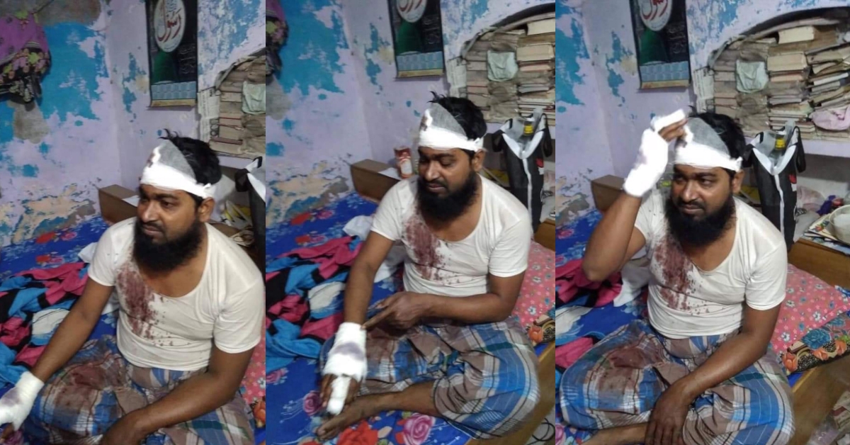 चोर के हमले से घायल इमाम की तस्वीर ‘संघ और बजरंग दल’ के सदस्यों द्वारा पिटाई के गलत दावे से शेयर