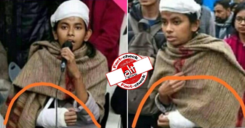 JNUSU की अध्यक्ष आइशी घोष ने घायल होने का नाटक किया? नहीं, मिरर तस्वीर वायरल