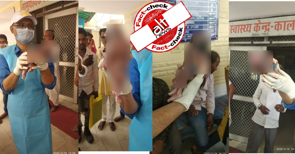 राजस्थान के गांव में एबनॉर्मल बच्ची पैदा हुई, तस्वीरें और वीडियो गलत दावे से वायरल