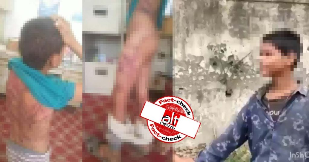 मंदिर से पानी पीने पर मुस्लिम लड़के की पिटाई के निशान बताकर यमन की तस्वीर वायरल