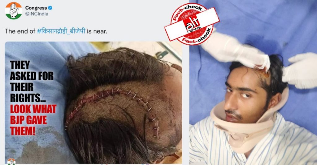कांग्रेस ने किसानों पर हुए लाठीचार्ज की बताकर जो तस्वीर शेयर की, वो असल में एक घायल ‘गौरक्षक’ की