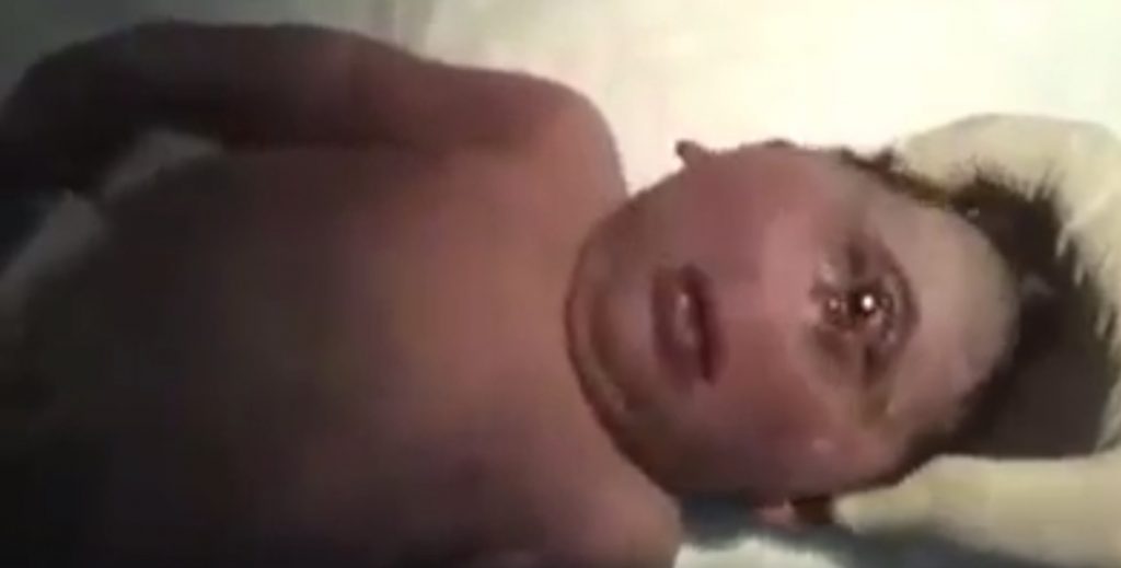 Old video of baby with rare birth defect shared as advent of ‘Antichrist’ born in Israel