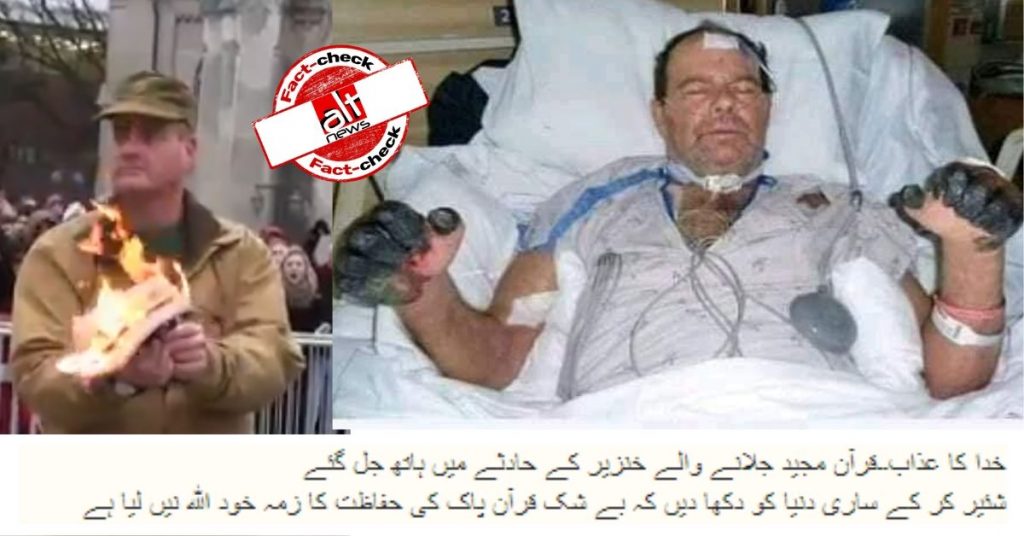 Image of man suffering from bubonic plague shared as hands burnt for burning Quran