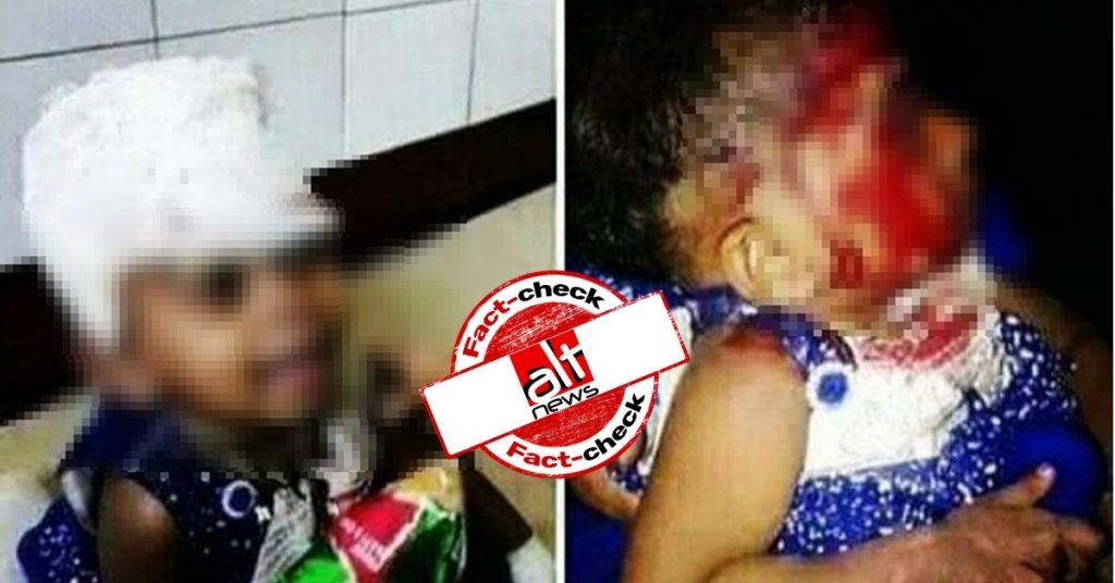 Photo from Bangladesh shared as toddler injured during anti-CAB protests in West Bengal