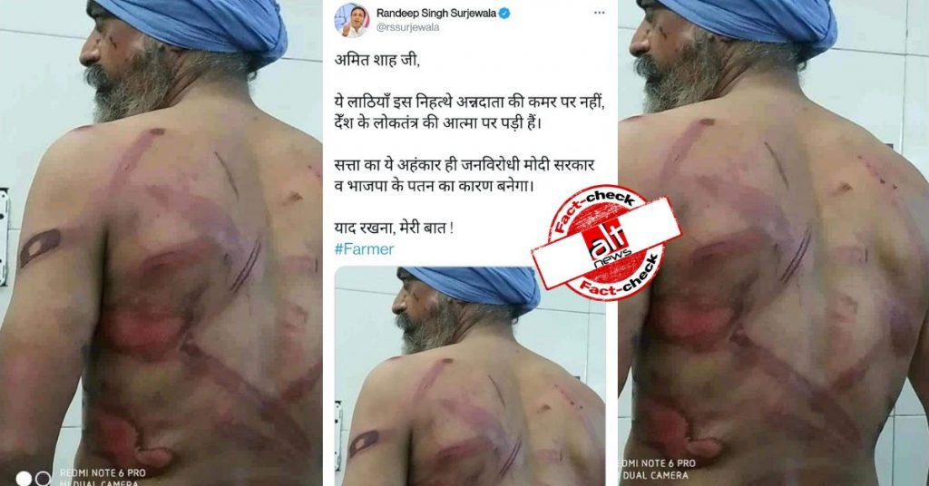 Image of injured Sikh man from 2019 falsely shared as police brutality during farmers’ protest
