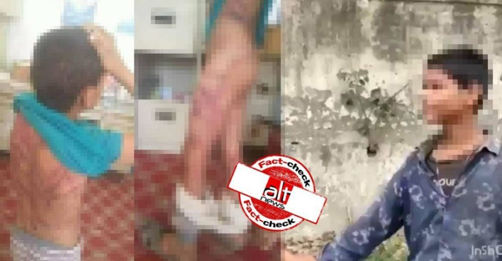 Photos from Yemen viral as injuries of Muslim boy beaten for entering temple to drink water