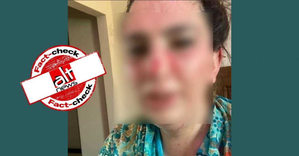 Photo of Pak trans activist shared as daughter of Afghan ambassador to Islamabad
